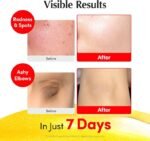 ⁦EQQUAL BERRY SERUM اصفر30 مل⁩ - الصورة ⁦3⁩