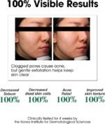 ⁦SOME BY MI AHA TONER 150ML⁩ - الصورة ⁦4⁩