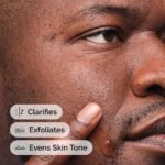 ⁦SALICYLIC ACID 2% 30 ML اوردينا⁩ - الصورة ⁦6⁩