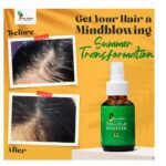 ⁦رو افريكان فوليكال بوستر زيت 100 مل⁩ - الصورة ⁦5⁩