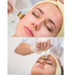 ⁦ZGTS ديرما رولر 0.75⁩ - الصورة ⁦6⁩